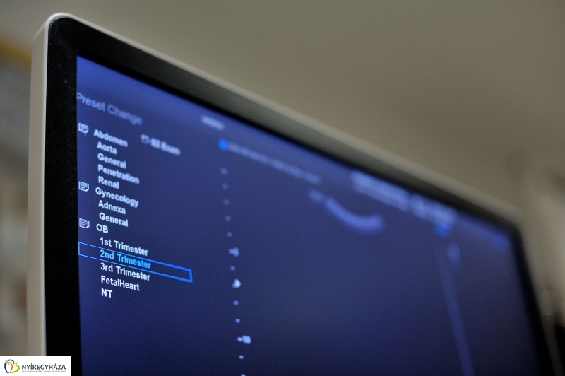 Új ultrahang készülék a Jósa András Kórházban
