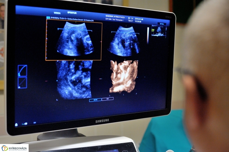 Új ultrahang készülék a Jósa András Kórházban