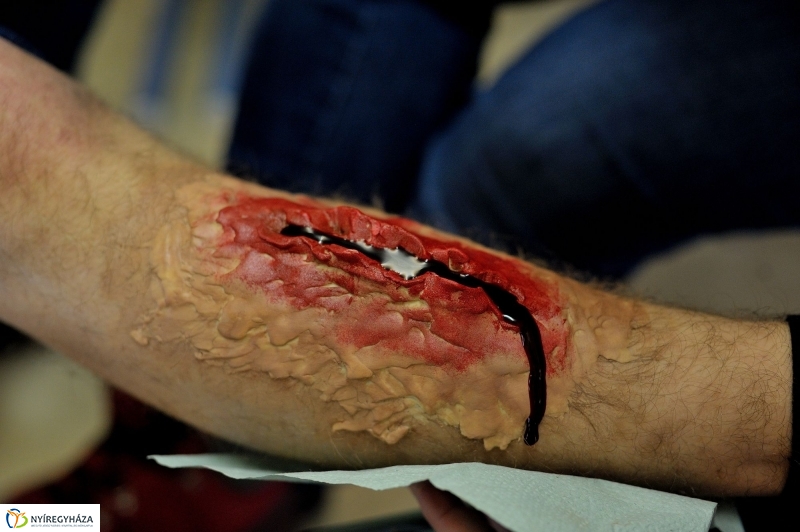 Egészségügyi gyakorlat a főiskolán