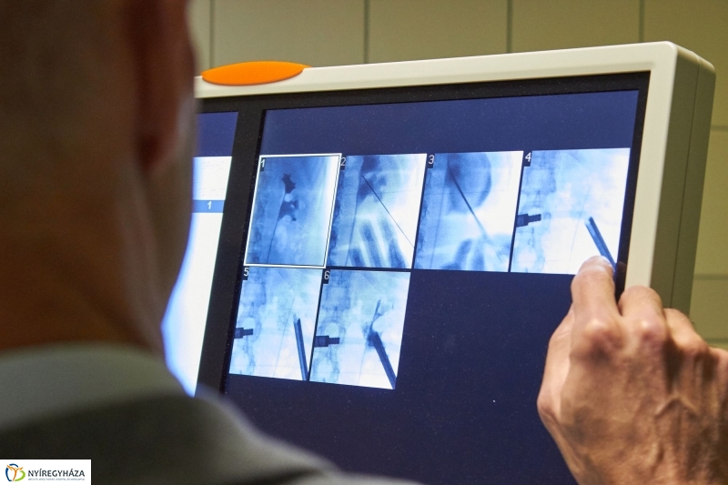 Új műtőasztal és röntgen a kórházban - fotó Szarka Lajos