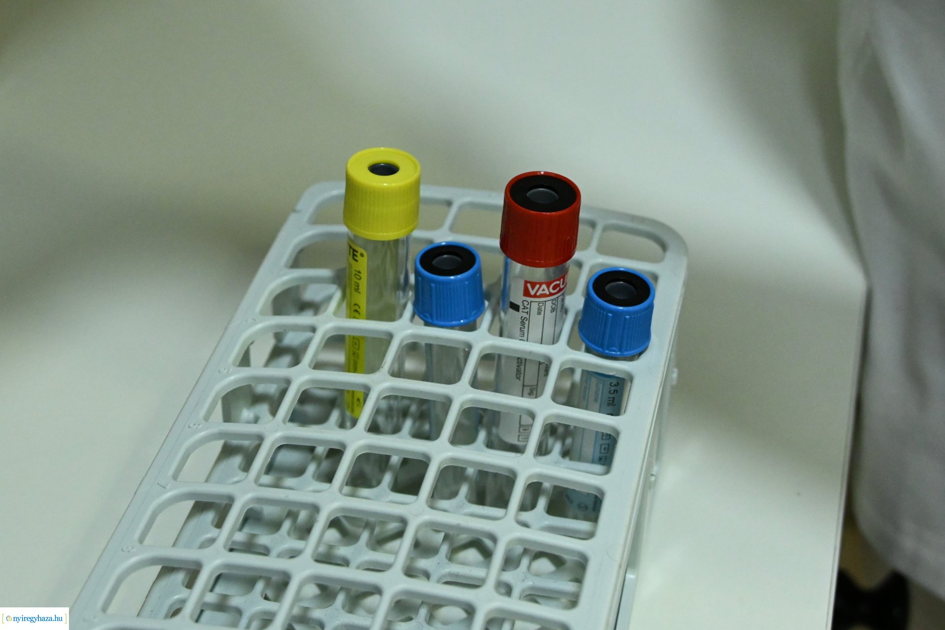 Egészségügyi szűrőhét a Nyírségi Egészség Kontroll Bt-nél