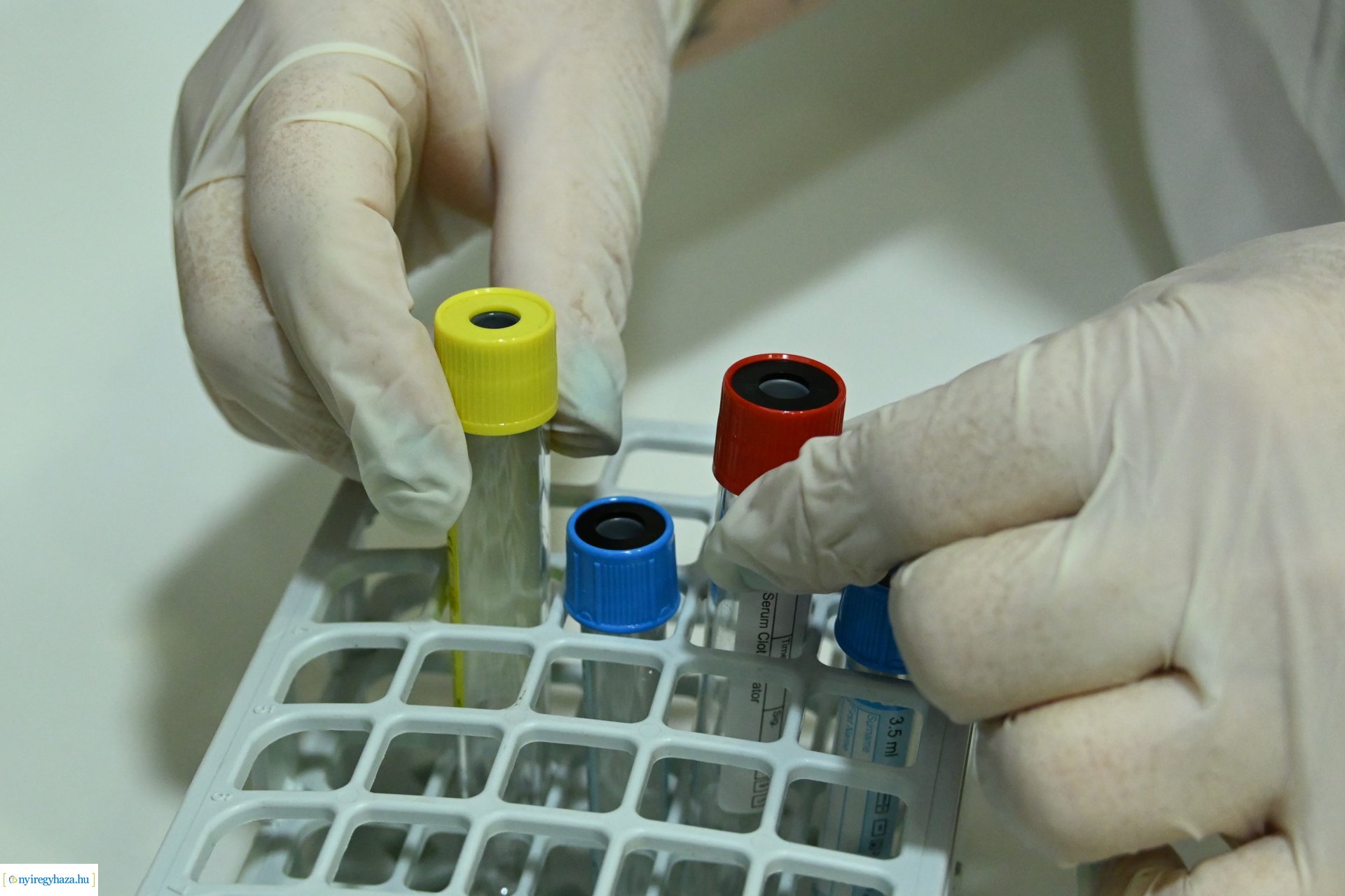 Egészségügyi szűrőhét a Nyírségi Egészség Kontroll Bt-nél