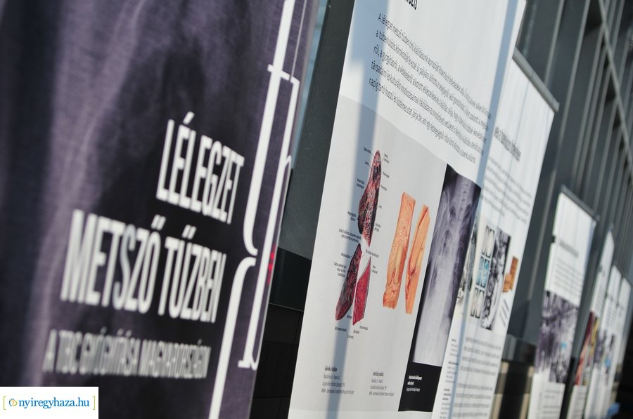 Lélegzet metsző tűzben - kiállítás