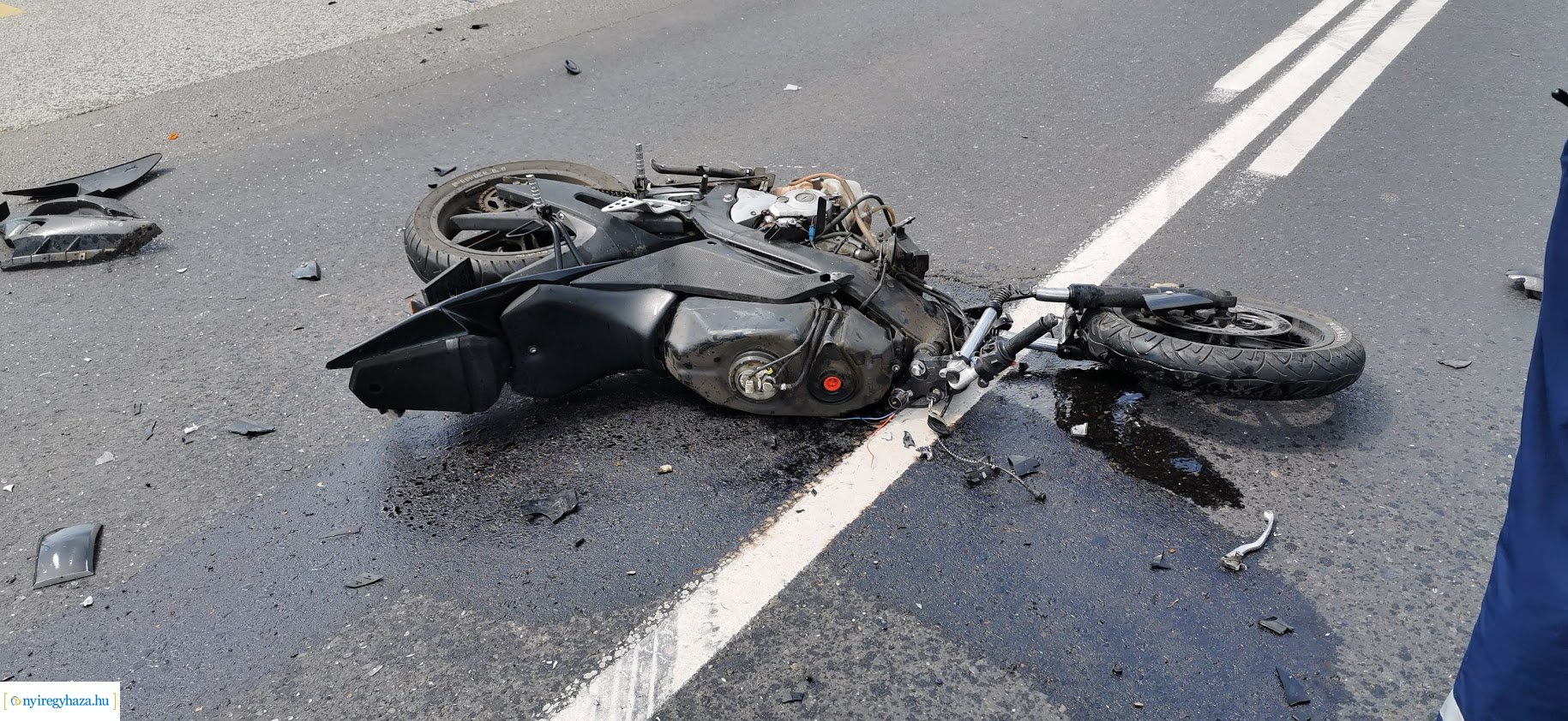 Motoros baleset a 36-os főútvonalon