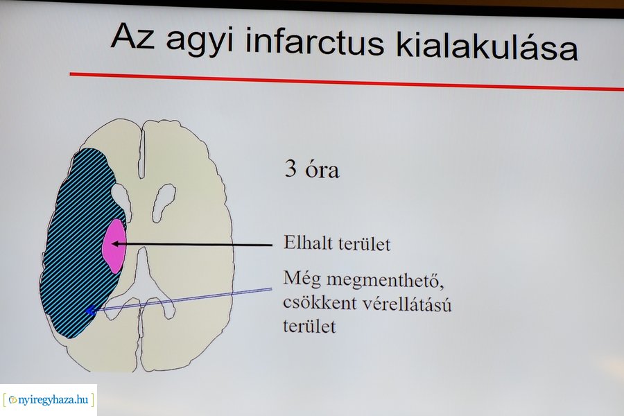 Neurológiai konferencia a kórházban 2022
