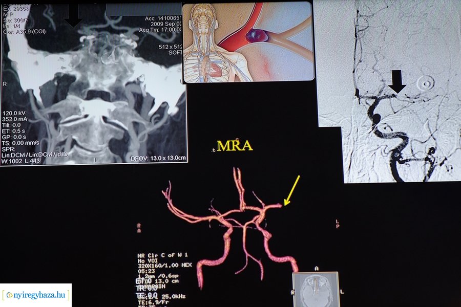 Neurológiai konferencia a kórházban 2022