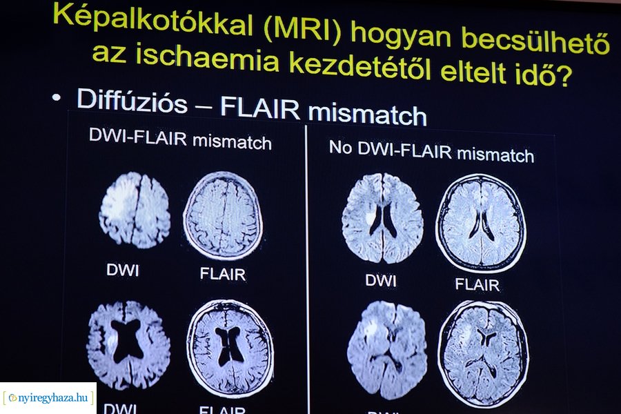 Neurológiai konferencia a kórházban 2022