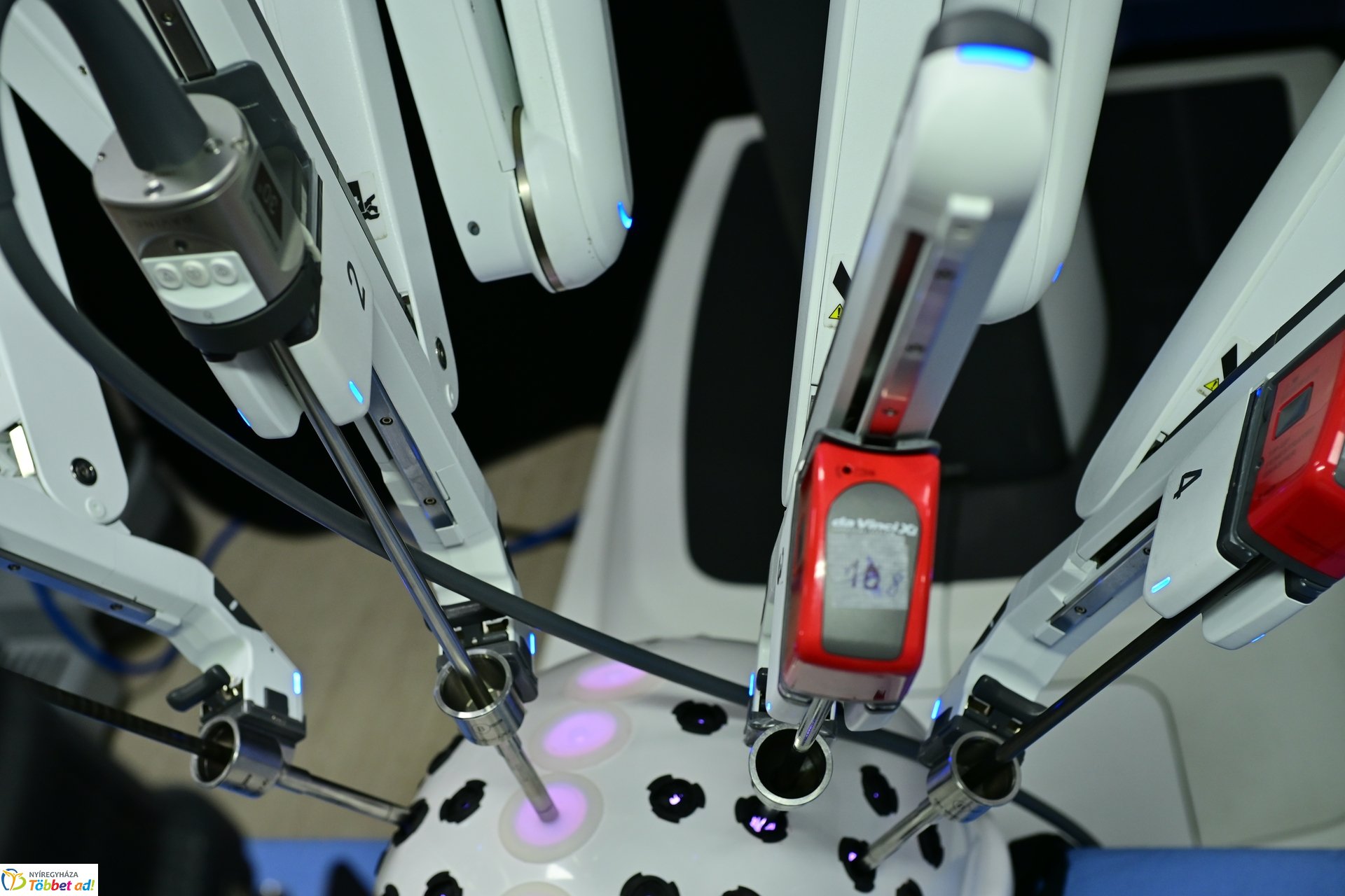 Robotsebészeti bemutató a Jósa András Kórházban 2025 márciusában