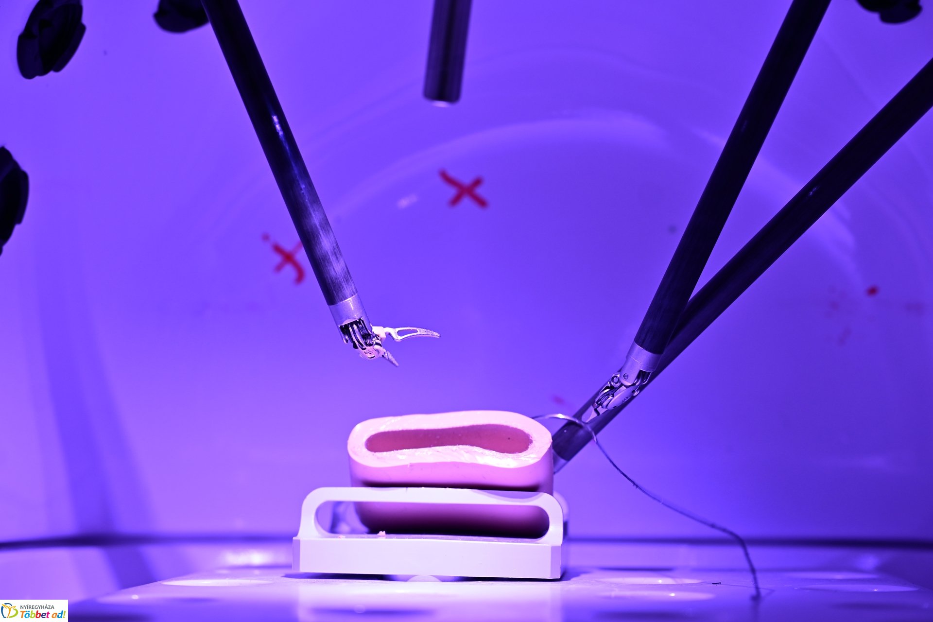 Robotsebészeti bemutató a Jósa András Kórházban 2025 márciusában