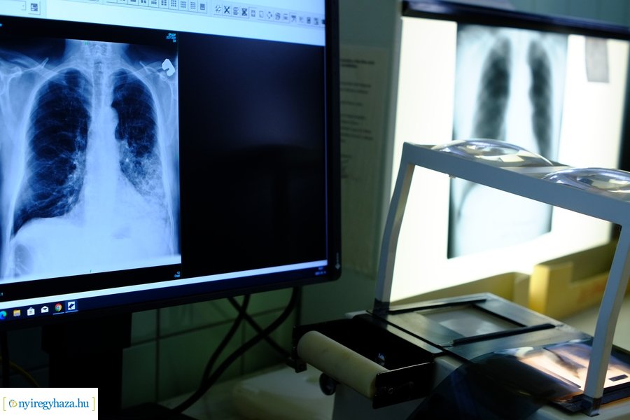 Új eszközök a tüdőgondozóban