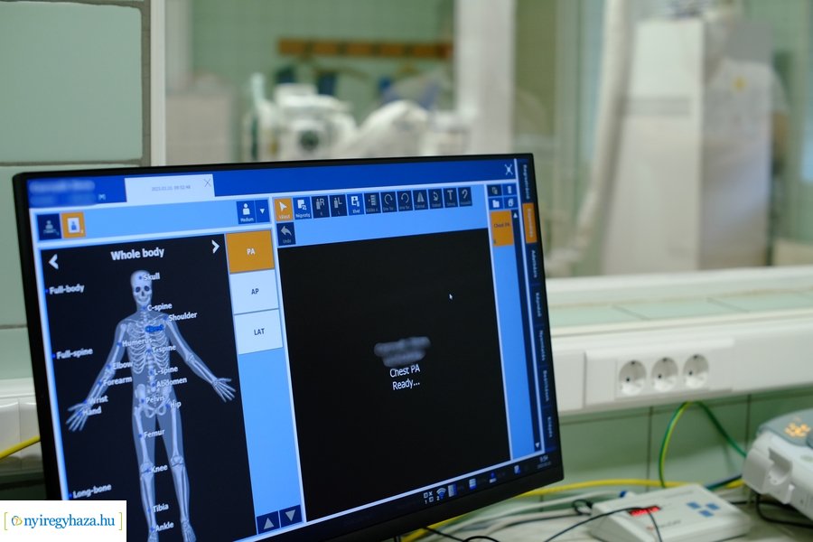 Új eszközök a tüdőgondozóban