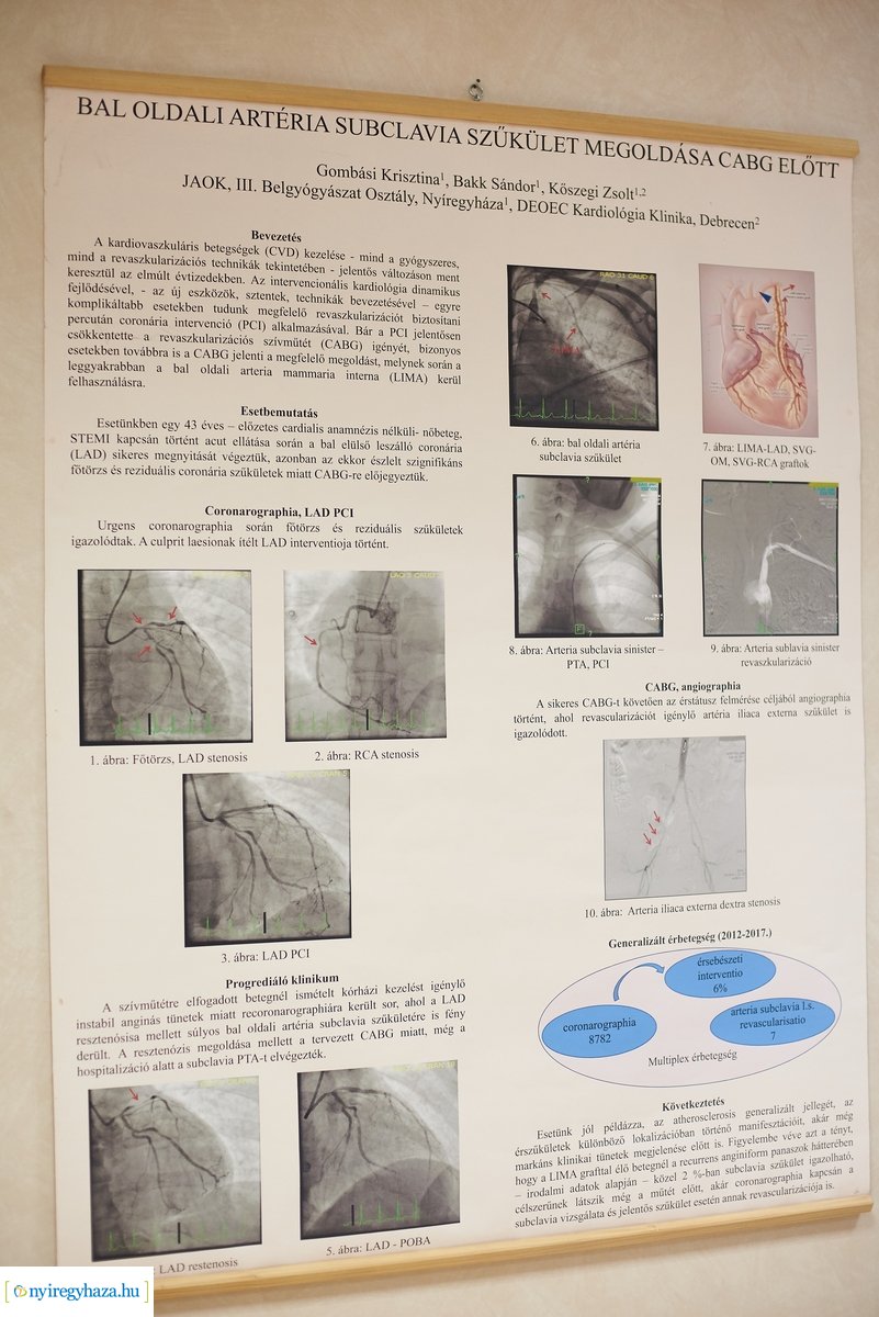 Új katéteres eljárás a kórházban