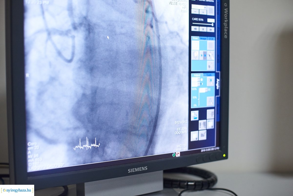 Új katéteres eljárás a kórházban