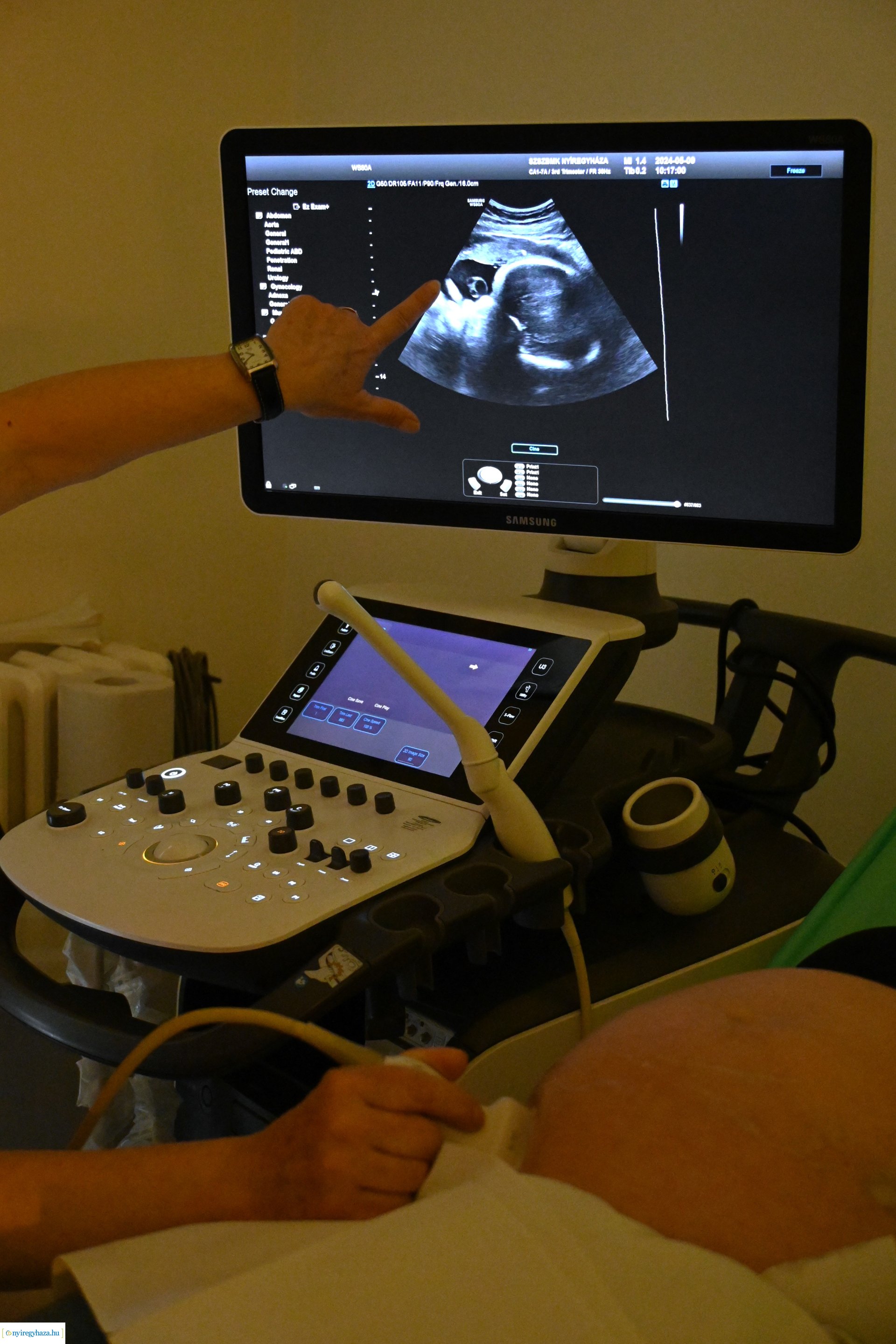 Várandósság hete - nyílt nap a szülészeten