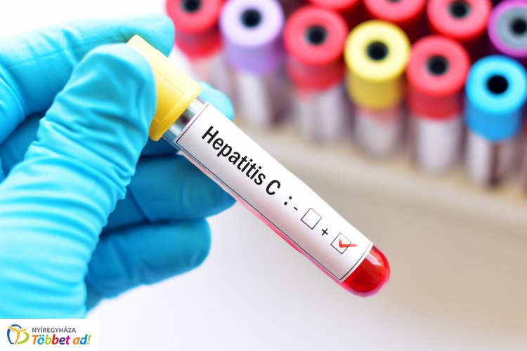 Ismét ingyenes hepatitis C szűrés országszerte – Nyíregyházán is!