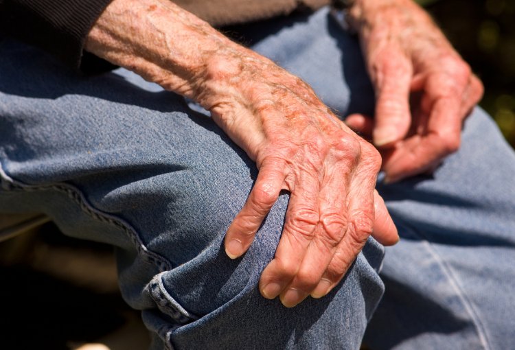 az artritisz megelőzésére