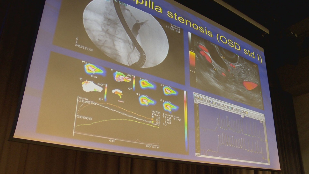 Endoszkópos Vándorgyűlés