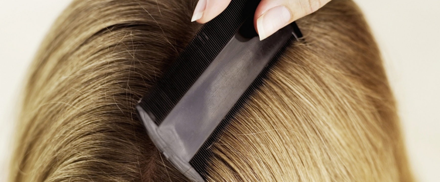 Kevesebb a fejtetűvel fertőzött gyerek