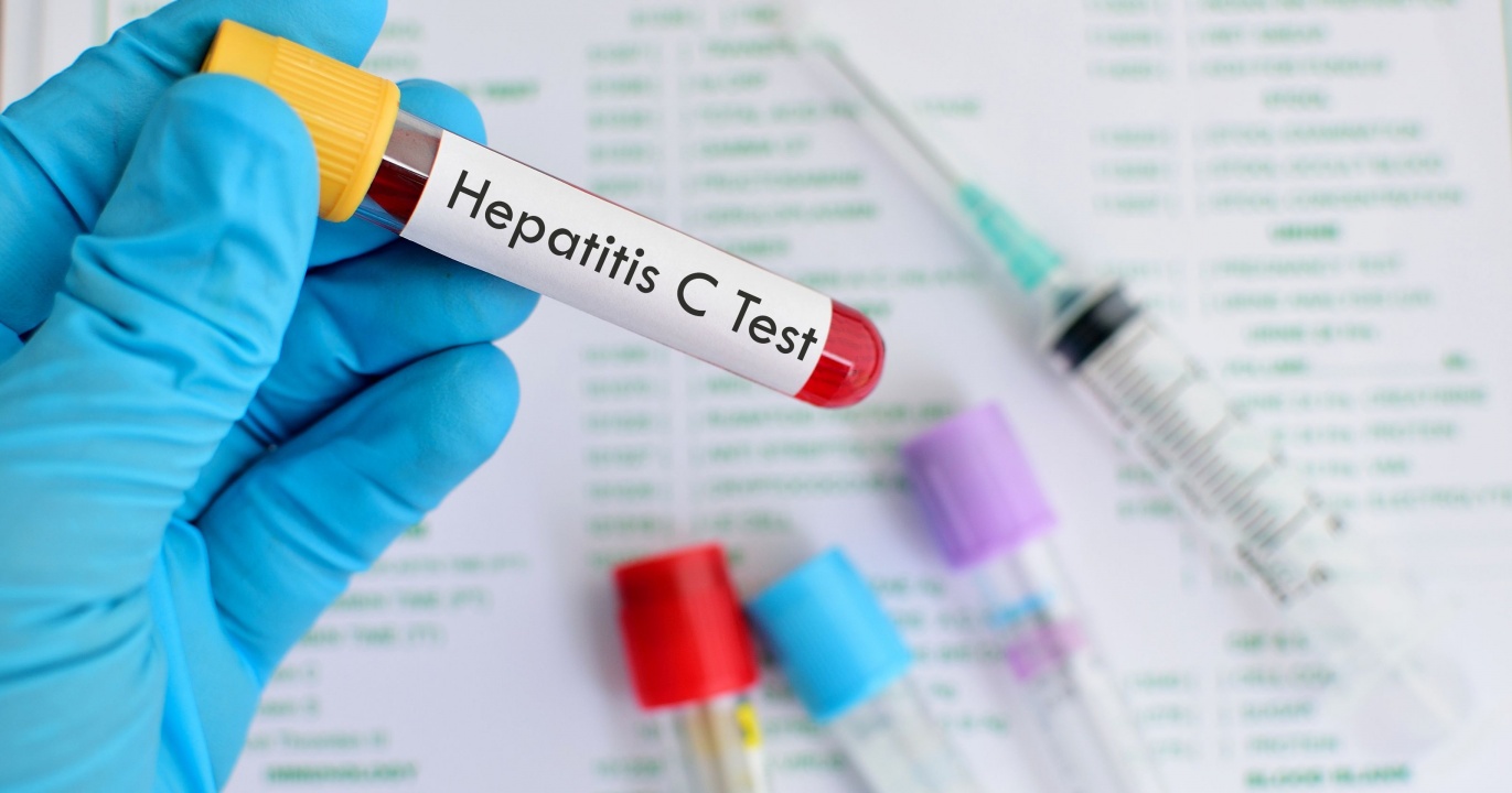 Hepatitis C: új utak a gyógyításában