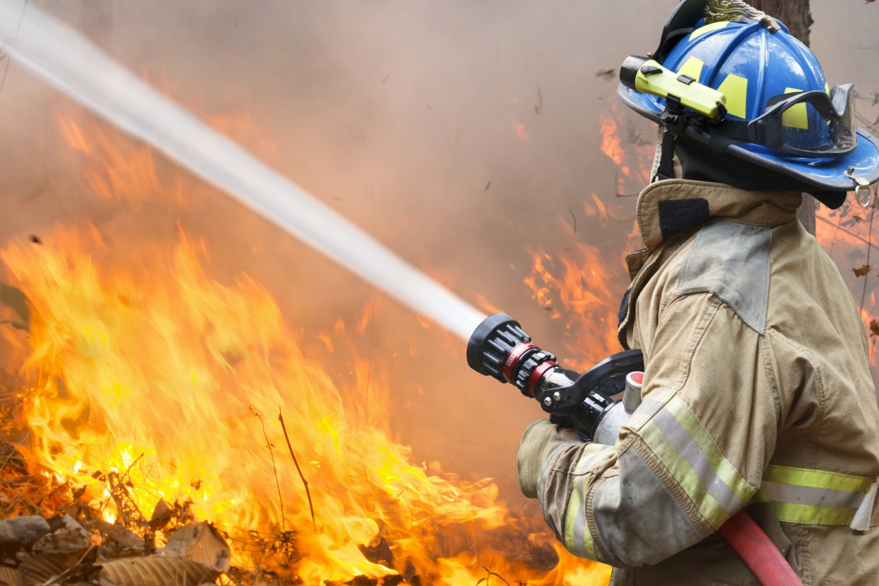 Súlyos égési sérüléseket szenvedett egy ember a nyírbogáti tűzesetben